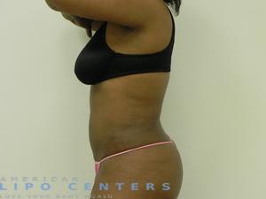 americanlipocenters_821.jpg